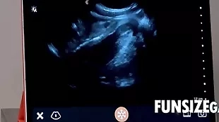 Ultra sound bowels of the earth inhibit - dr wolf, austin